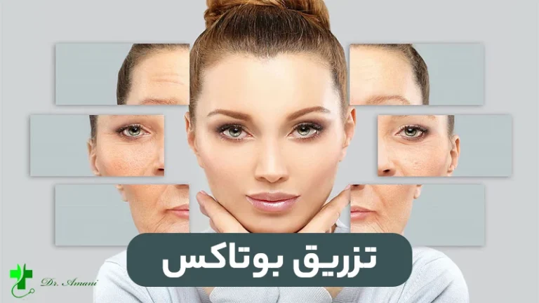 بهترین کلینیک بوتاکس در رشت