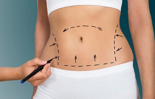 Complications of abdominal surgery