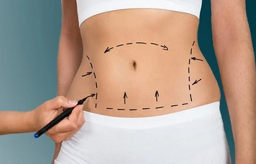 Complications of abdominal surgery