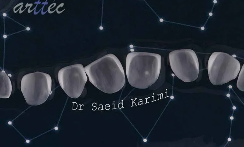 How do they fix a rotten tooth