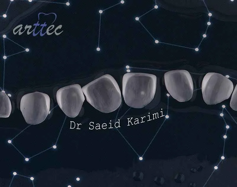 How do they fix a rotten tooth