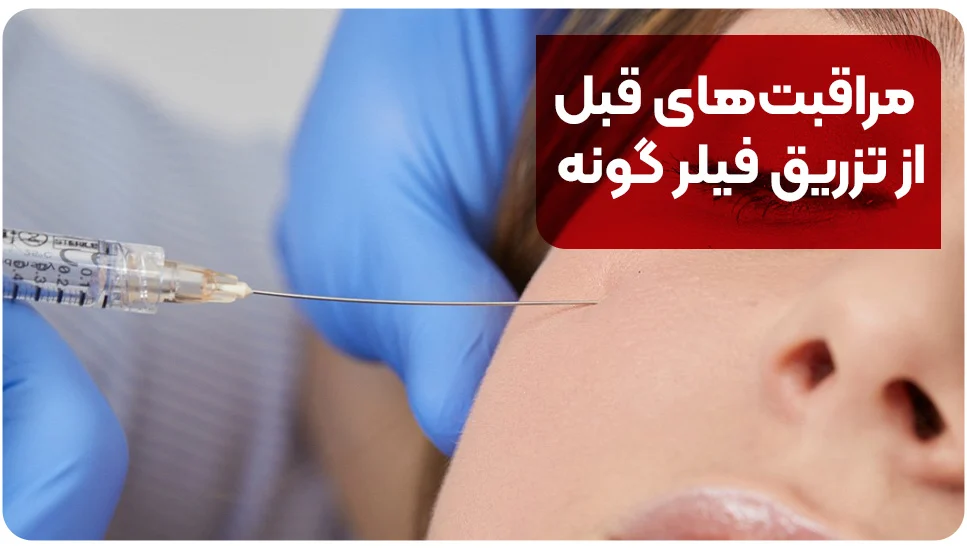 مراقبت&zwnj;های قبل از تزریق فیلر گونه